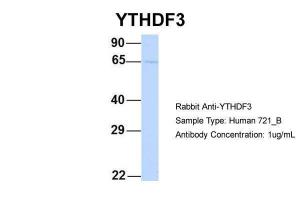 Anti-YTHDF3 Rabbit Polyclonal Antibody