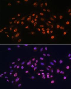 Immunofluorescence analysis of C6 cells using Anti-EFTUD2 Antibody (A12061) at a dilution of 1:100. DAPI was used to stain the cell nuclei (blue).