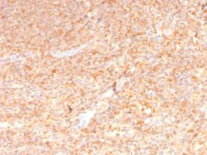 Anti-GM-CSF Mouse Monoclonal Antibody [clone: CSF2/3402]