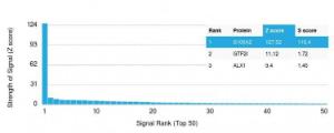 Analysis of protein array containing more than 19,000 full-length human proteins using Anti-S100A2 Antibody [CPTC-S100A2-2] Z-Score and S- Score