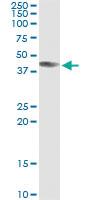 Anti-ART3 Mouse Monoclonal Antibody [clone: 1D2]