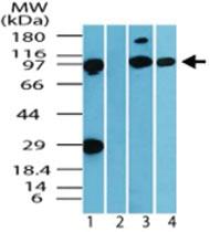 Anti-DCAF6 Rabbit Polyclonal Antibody