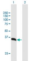 Anti-PSMD14 Mouse Polyclonal Antibody