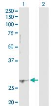 Anti-PCGF1 Rabbit Polyclonal Antibody