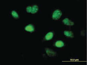 Anti-LHX5 Mouse Monoclonal Antibody [clone: 2B11]