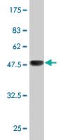 Anti-RAB11A Mouse Monoclonal Antibody [clone: 1F7-2A8]