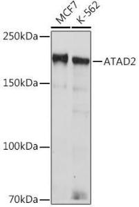 Western blot analysis of extracts of various cell lines, using Anti-ATAD2 Antibody [ARC2317] (A307994) at 1:1,000 dilution. The secondary antibody was Goat Anti-Rabbit IgG H&L Antibody (HRP) at 1:10,000 dilution.