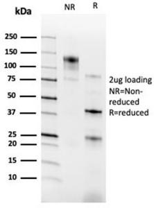 SDS-PAGE analysis of Anti-RXRG Antibody [PCRP-RXRG-5H4] under non-reduced and reduced conditions; showing intact IgG and intact heavy and light chains, respectively SDS-PAGE analysis confirms the integrity and purity of the antibody