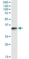 Anti-ART4 Mouse Polyclonal Antibody