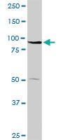 Anti-ABCB9 Rabbit Polyclonal Antibody