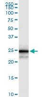 Anti-MPZL2 Polyclonal Antibody Pair