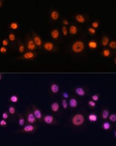 Immunofluorescence analysis of HeLa cells using Anti-EFTUD2 Antibody (A12061) at a dilution of 1:100. DAPI was used to stain the cell nuclei (blue).