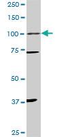 Anti-PGR Mouse Monoclonal Antibody [clone: 3E11]