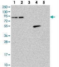 Anti-ANKS3 Rabbit Polyclonal Antibody