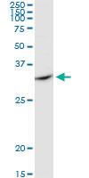 Anti-SULT1E1 Rabbit Polyclonal Antibody