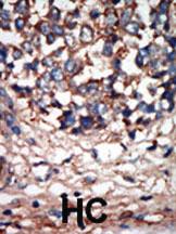 Anti-NEK9 Rabbit Polyclonal Antibody