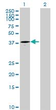 Anti-ART4 Mouse Polyclonal Antibody