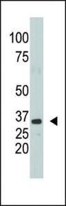 Anti-SULT1A1 Rabbit Polyclonal Antibody (APC (Allophycocyanin))