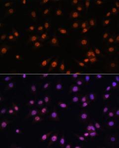 Immunofluorescence analysis of L929 cells using Anti-EFTUD2 Antibody (A12061) at a dilution of 1:100. DAPI was used to stain the cell nuclei (blue).