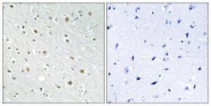 Immunohistochemical analysis of paraffin-embedded human brain tissue using Anti-SSBP2 Antibody. The right hand panel represents a negative control, where the antibody was pre-incubated with the immunising peptide