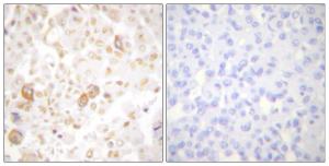 Anti-Cyclin F antibody