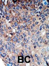 Anti-NM23 (NME1) Rabbit Polyclonal Antibody