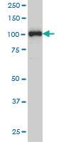 Anti-PGR Mouse Monoclonal Antibody [clone: 3E11]