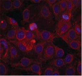 Anti-KDR Rabbit Polyclonal Antibody