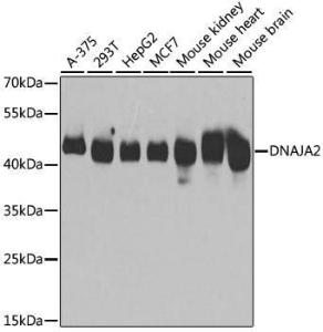 Western blot analysis of extracts of various cell lines, using Anti-DNAJA2 Antibody (A12063) at 1:3,000 dilution. The secondary antibody was Goat Anti-Rabbit IgG H&L Antibody (HRP) at 1:10,000 dilution.