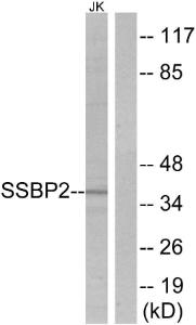 Western blot analysis of lysates from Jurkat cells using Anti-SSBP2 Antibody. The right hand lane represents a negative control, where the antibody is blocked by the immunising peptide