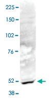 Anti-ACTL6B Rabbit Polyclonal Antibody