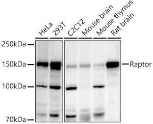 Western blot analysis of extracts of various cell lines, using Anti-Raptor Antibody (A306753) at 1:500 dilution. The secondary Antibody was Goat Anti-Rabbit IgG H&L Antibody (HRP) at 1:10000 dilution