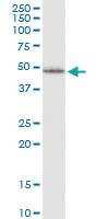 Anti-LHX5 Mouse Monoclonal Antibody [clone: 2C6]