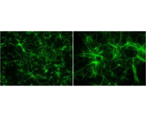 MAP2 staining in fixed and permeabilized striatal neurons (7 DIV) by Immunocytochemistry. Primary antibody concentration: 1 µg/ml. Image courtesy of QBM Cell Science.