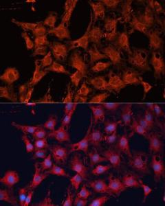 Immunofluorescence analysis of C6 cells using Anti-DNAJA2 Antibody (A12063) at a dilution of 1:100. DAPI was used to stain the cell nuclei (blue).