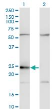 Anti-CD74 Mouse Monoclonal Antibody [clone: 1D1]