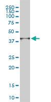 Anti-PSMD14 Mouse Monoclonal Antibody [clone: 4A10-E8]