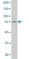 Anti-ABCA6 Mouse Polyclonal Antibody