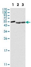 Anti-PTK6 Mouse Monoclonal Antibody [clone: 2H12B8]