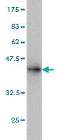 Anti-RAD18 Mouse Monoclonal Antibody [clone: 3H7]