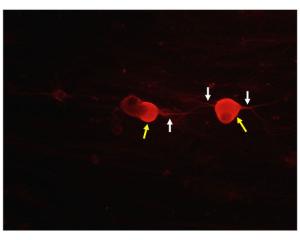 TrkA staining in fixed and permeabilized embryonic rat DRG neurons. TrkA-IR is observed in axonal projections (white arrows) and cell body (membrane and/or cytoplasmic compartments, yellow arrow), consistent with expected cellular localization. Image courtesy of QBM Cell Science.