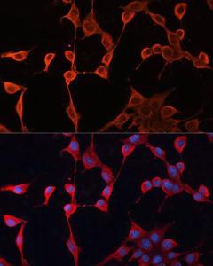 Immunofluorescence analysis of NIH/3T3 cells using Anti-DNAJA2 Antibody (A12063) at a dilution of 1:100. DAPI was used to stain the cell nuclei (blue).