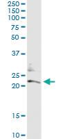 Anti-CD74 Mouse Monoclonal Antibody [clone: 1D1]