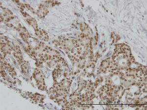 Anti-PGR Mouse Monoclonal Antibody [clone: 3E11]