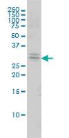 Anti-TOLLIP Mouse Monoclonal Antibody [clone: 1A5-2A3]