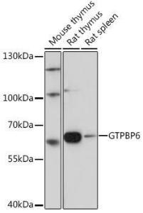 Western blot analysis of extracts of various cell lines, using Anti-PGPL Antibody (A307996) at 1:1000 dilution. The secondary Antibody was Goat Anti-Rabbit IgG H&L Antibody (HRP) at 1:10000 dilution. Lysates/proteins were present at 25 µg per lane