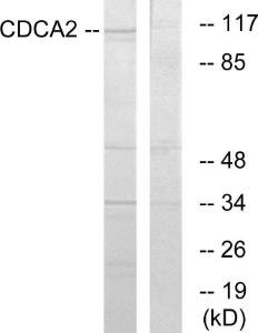 Western blot analysis of lysates from 293 cells using Anti-CDCA2 Antibody The right hand lane represents a negative control, where the antibody is blocked by the immunising peptide