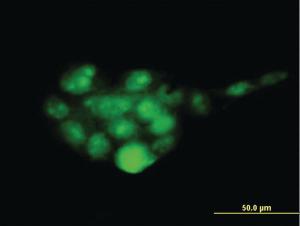 Anti-PSMD14 Mouse Monoclonal Antibody [clone: 4A10-E8]