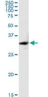 Anti-SULT1E1 Rabbit Polyclonal Antibody