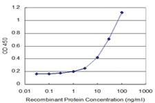 Anti-LHX5 Mouse Monoclonal Antibody [clone: 2C6]